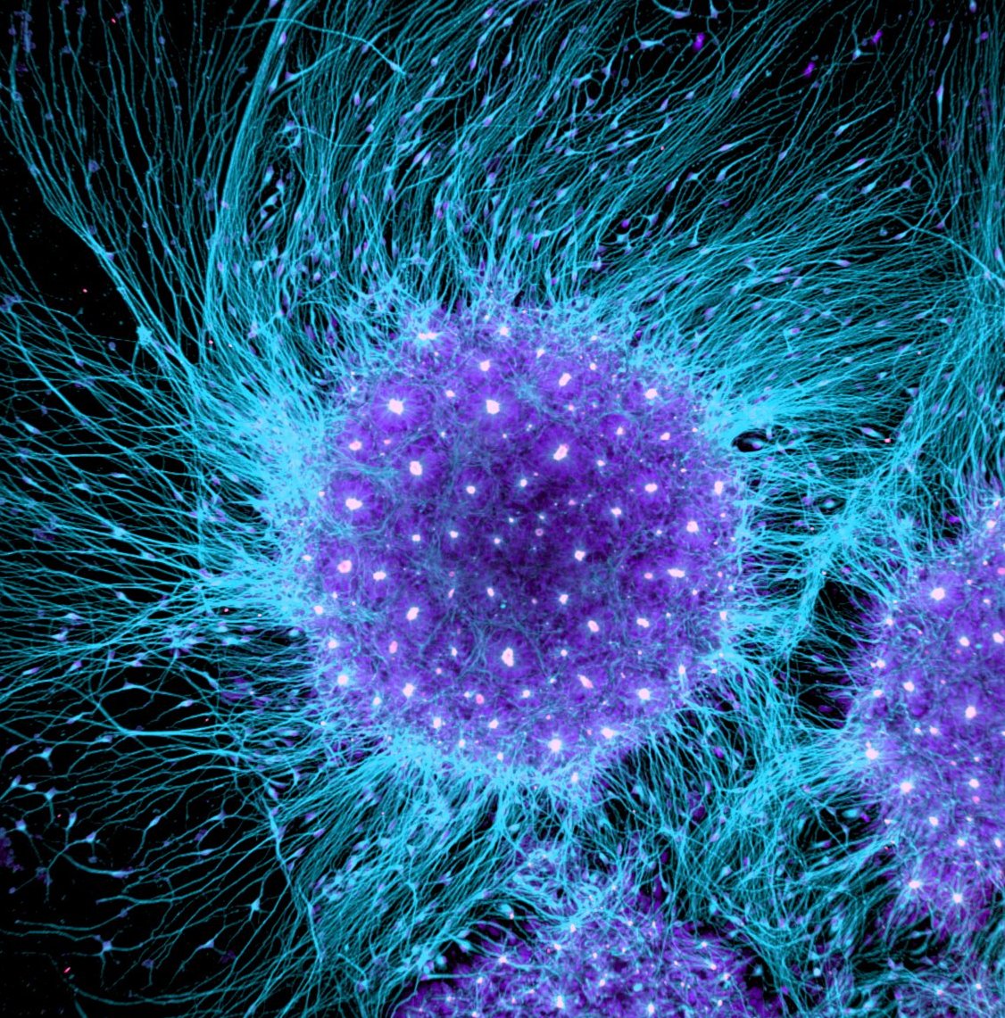 human-brain-cells-differentiated-from-embryonic-stem-cells